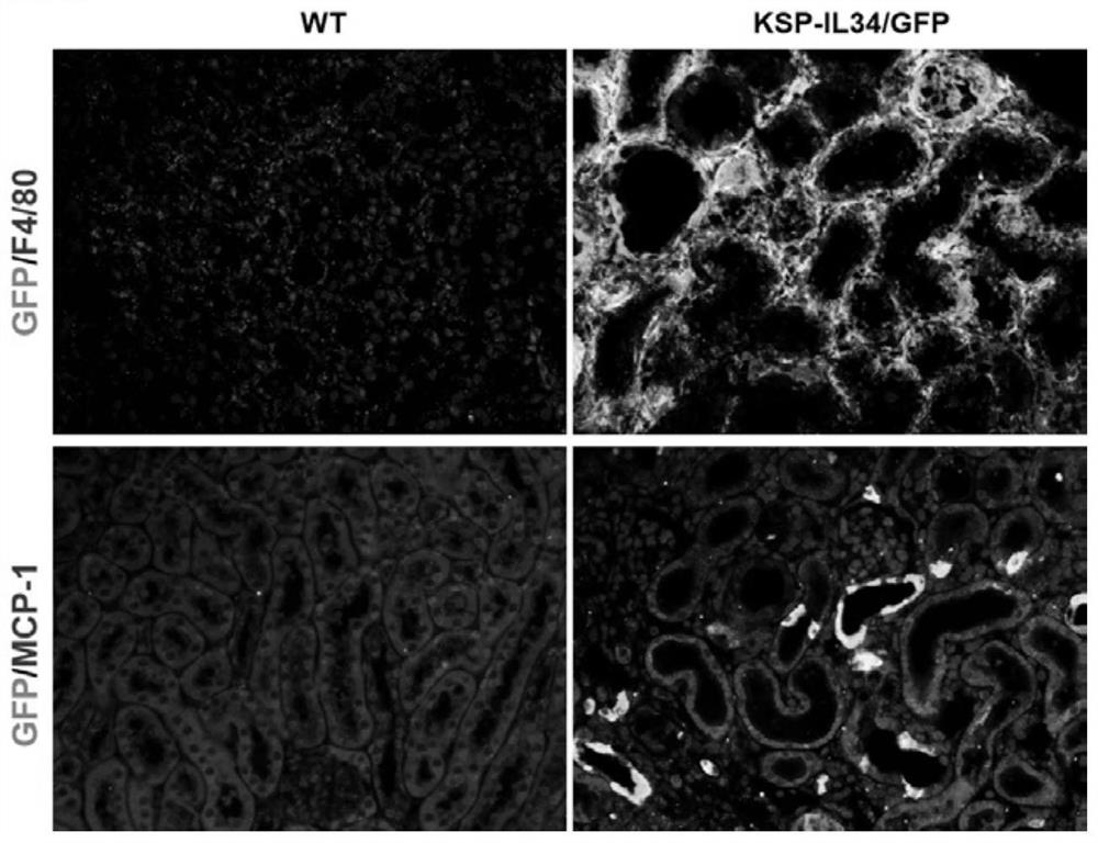 A method for constructing a mouse model of persistent intrinsic macrophage infiltration in the kidney