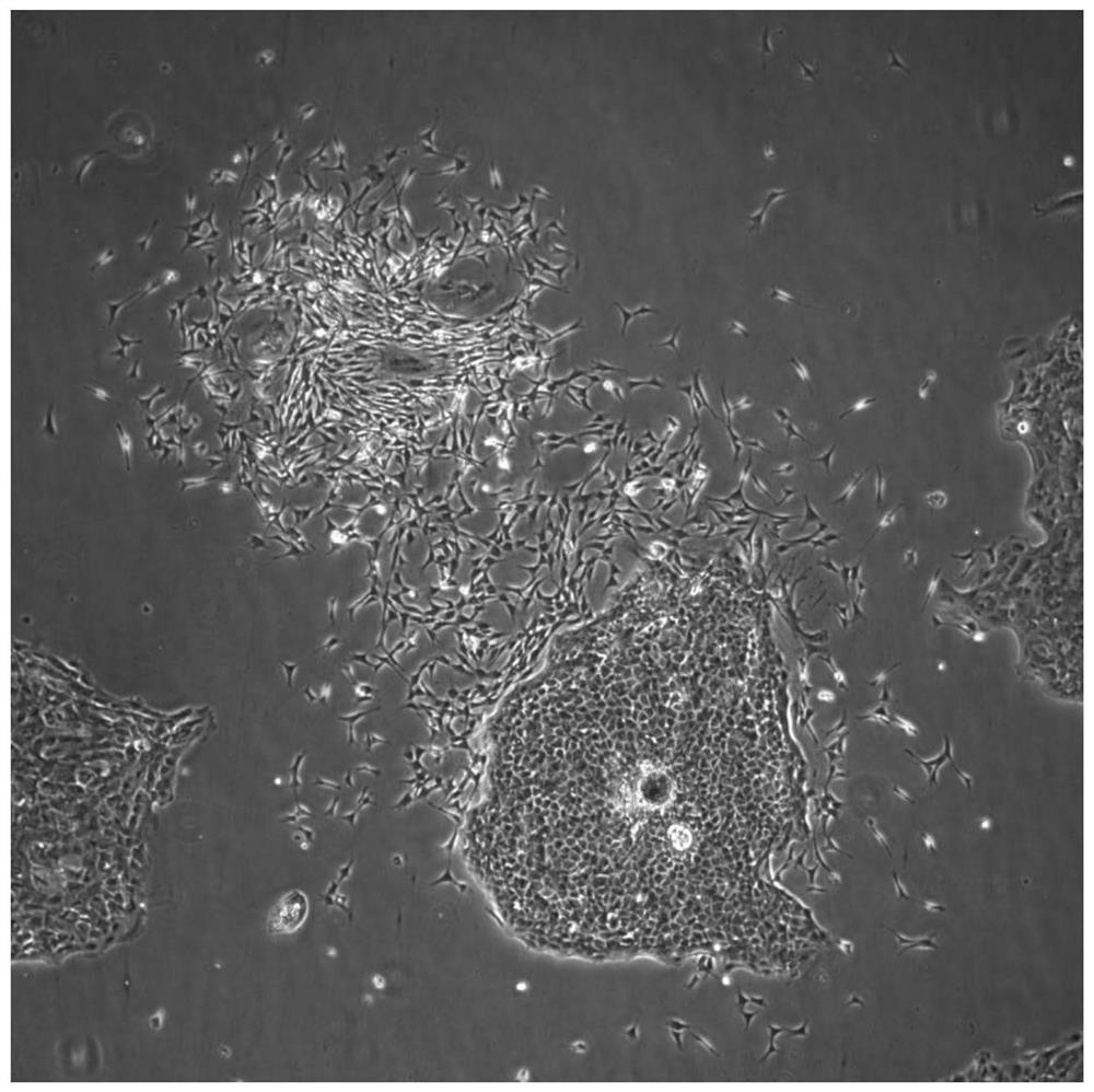 Construction method of immortalized forest musk gland epithelial cells