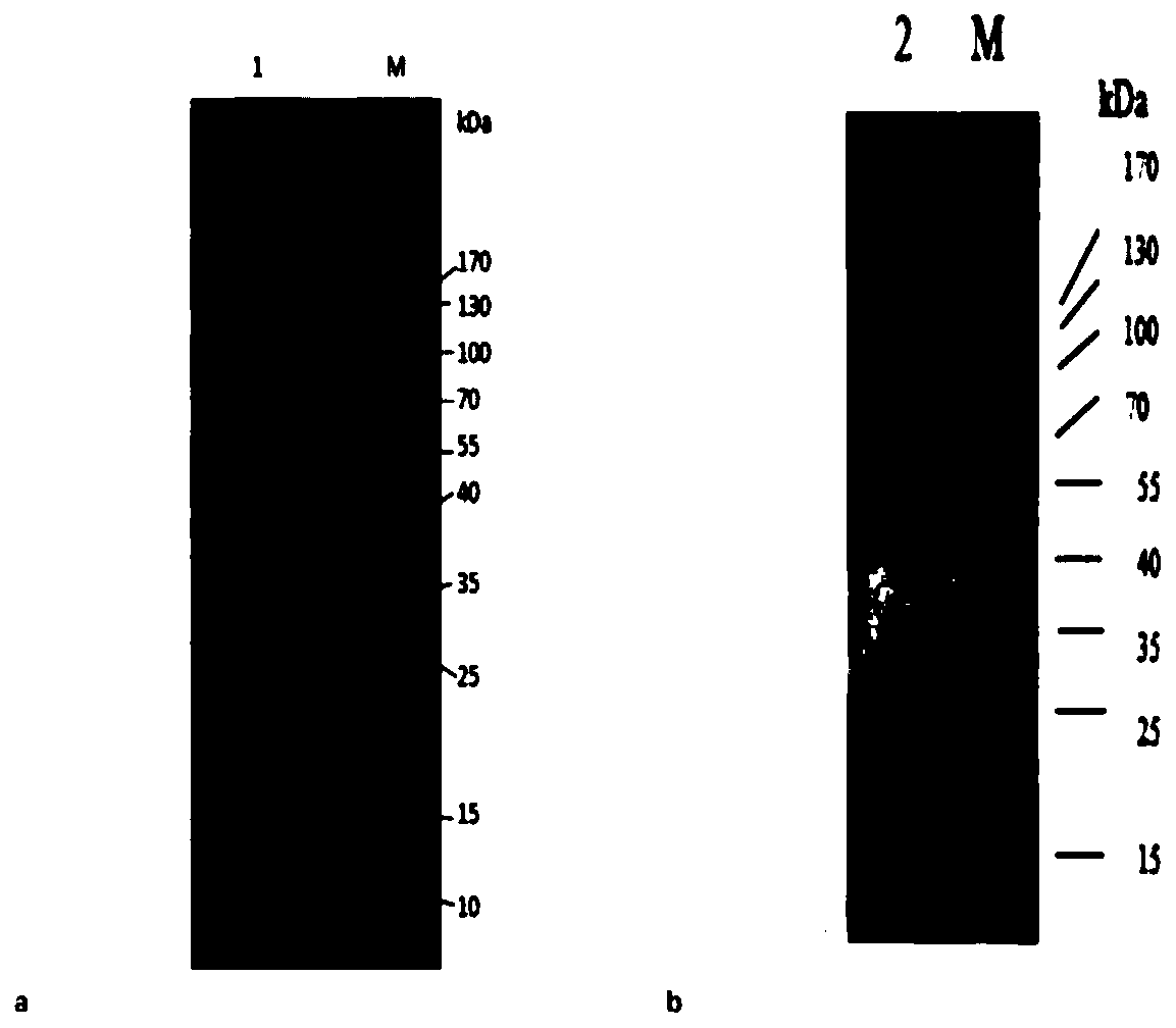 phthalate-degrading-enzyme-gene-and-coding-product-and-preparation