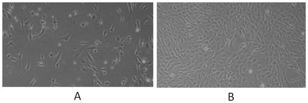 Endometrium stem cell exosome gel