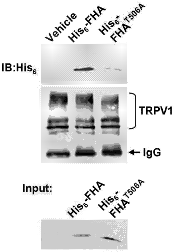 Polypeptide for preventing and/or treating pain and application of polypeptide