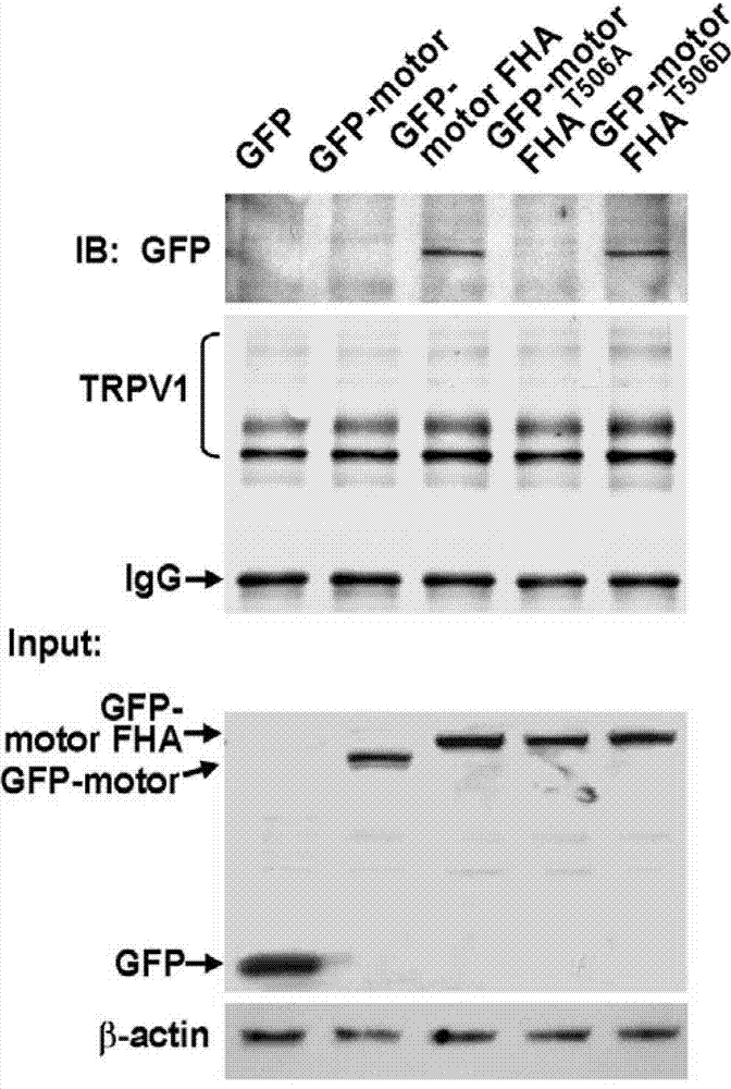 Polypeptide for preventing and/or treating pain and application of polypeptide