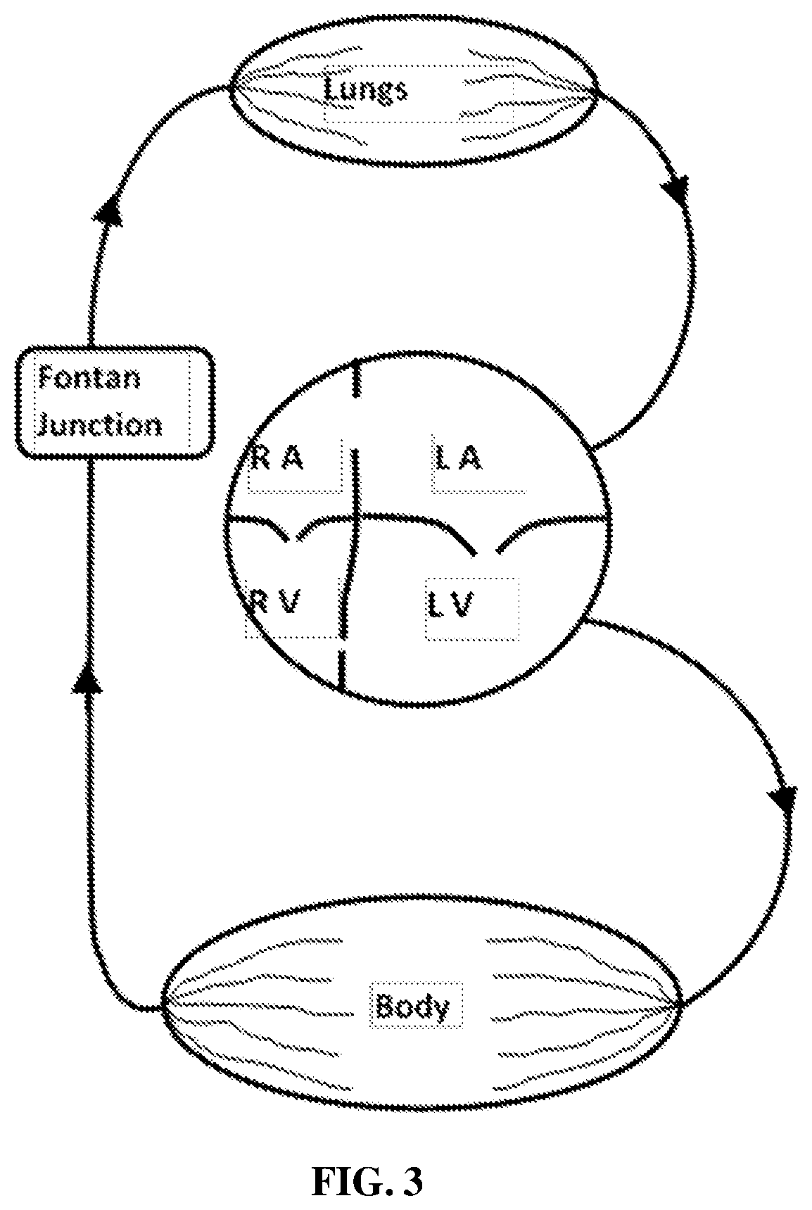 Implantable cardio-vascular flow streamliner