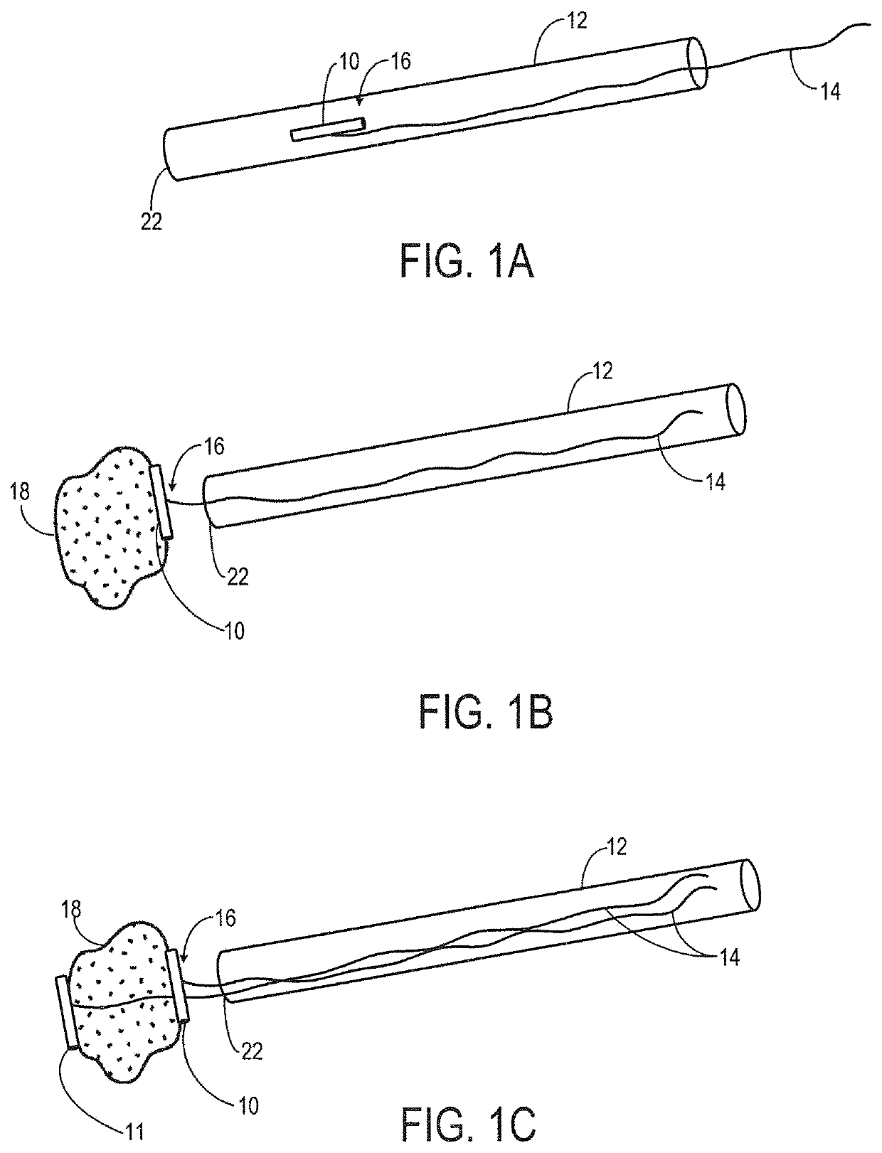 System and method for a tissue resection margin measurement device