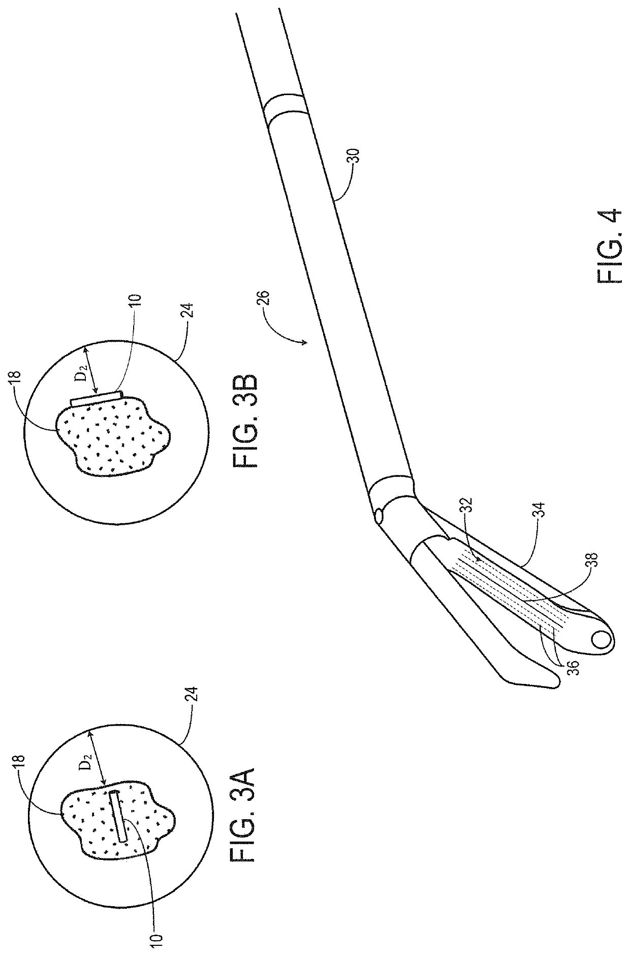 System and method for a tissue resection margin measurement device