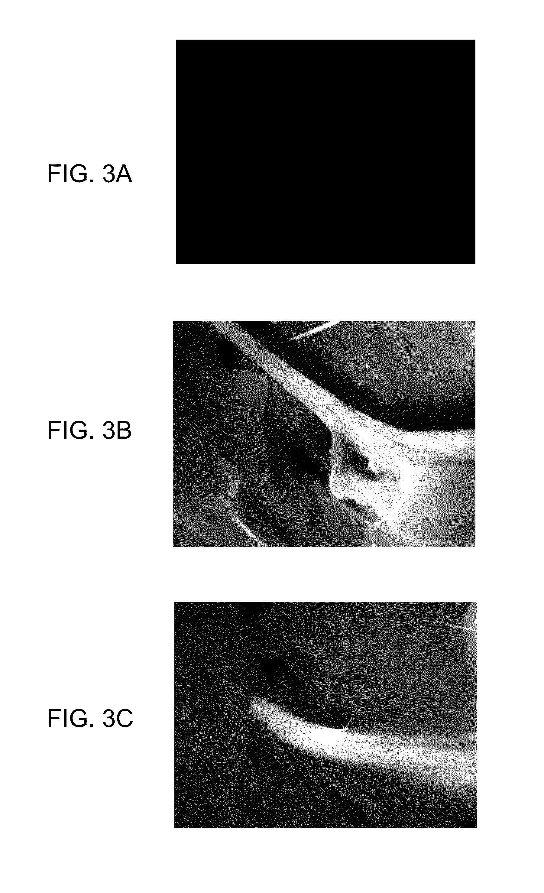 Methods of detecting myelin basic protein