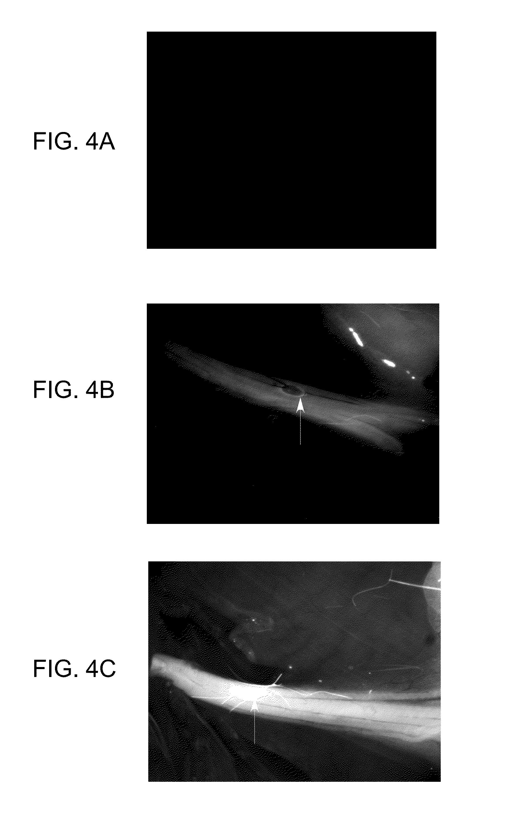 Methods of detecting myelin basic protein