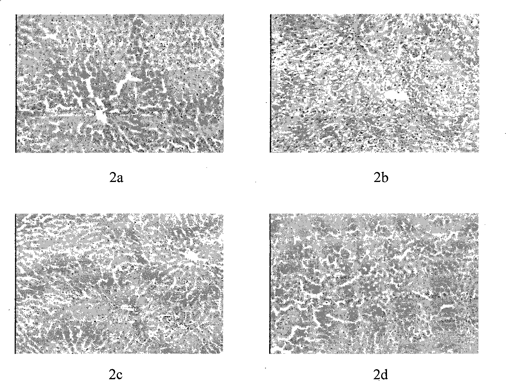 Chinese medicine with functions for reducing fat and clearing liver and preparation method thereof
