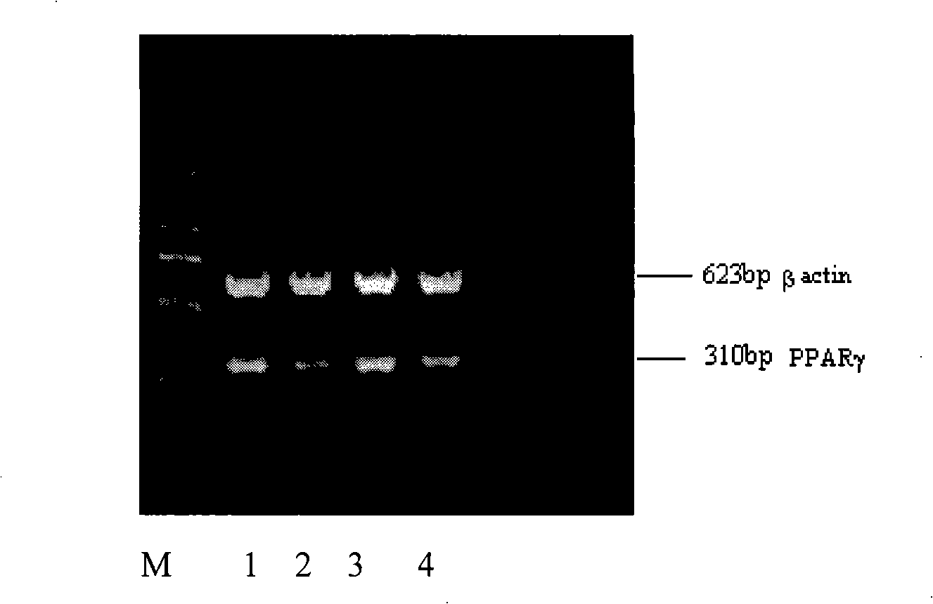Chinese medicine with functions for reducing fat and clearing liver and preparation method thereof
