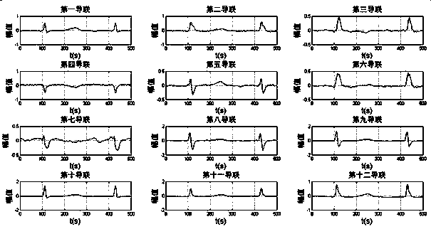 12-lead electrocardiosignal multi-label classification method based on neural network