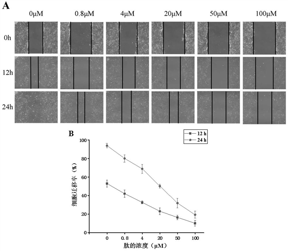 Non-natural amino acid short peptide and application thereof in tumor resistance