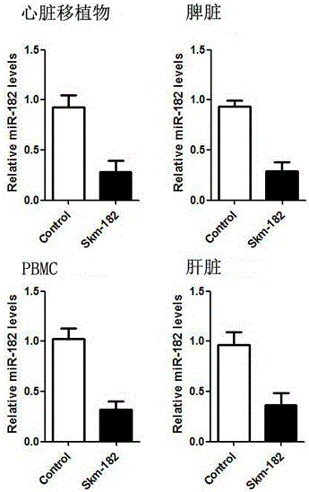 MiRNA-182 inhibitor and application thereof in preparation of drug for preventing and treating immunological rejection of heart transplantation