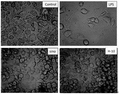 Preparation and medical application of binary structure sinomenine derivatives