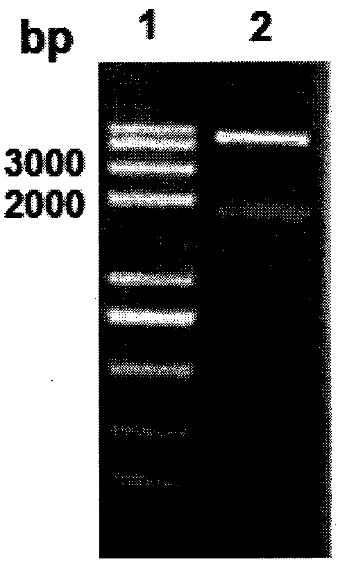 A kind of Helicobacter pylori multivalent epitope vaccine and preparation method thereof