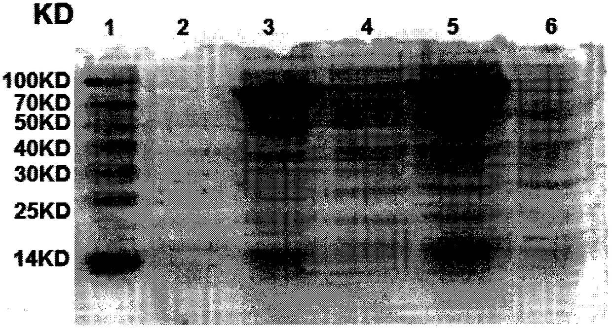 A kind of Helicobacter pylori multivalent epitope vaccine and preparation method thereof