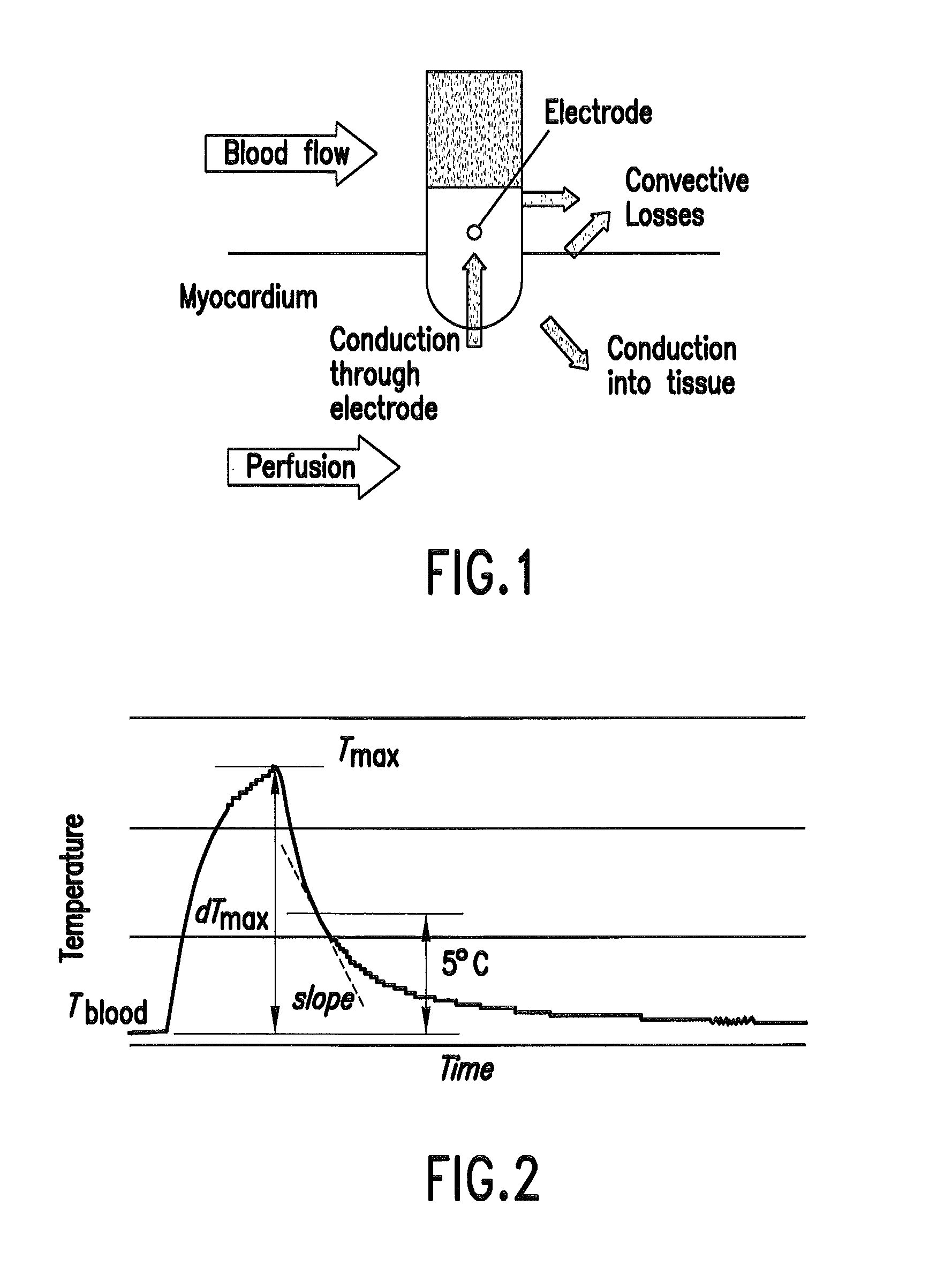 Method and devices for cardiac radiofrequency catheter ablation