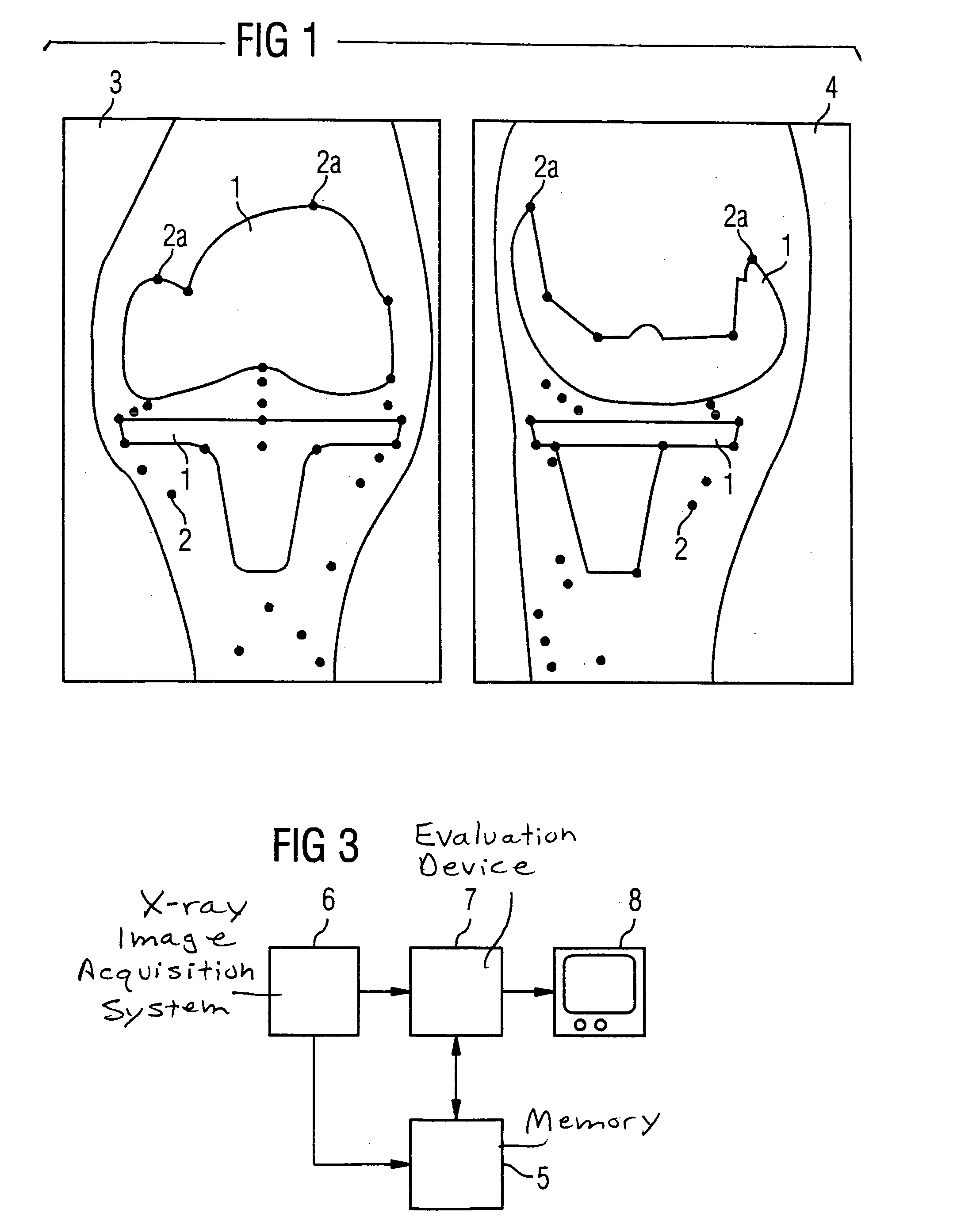 Method and x-ray system for detecting position changes of a medical implant
