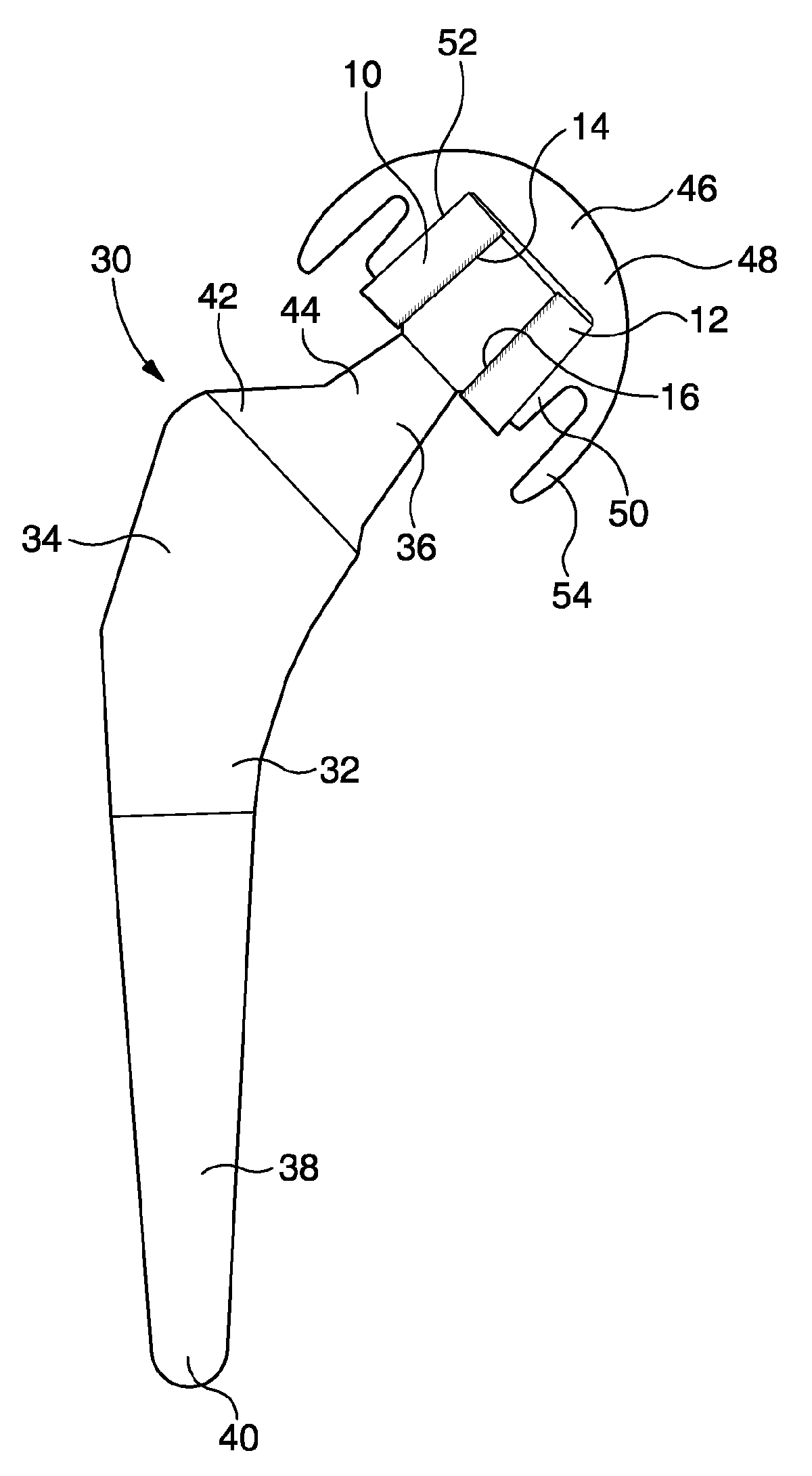 Prosthesis having a large femoral head