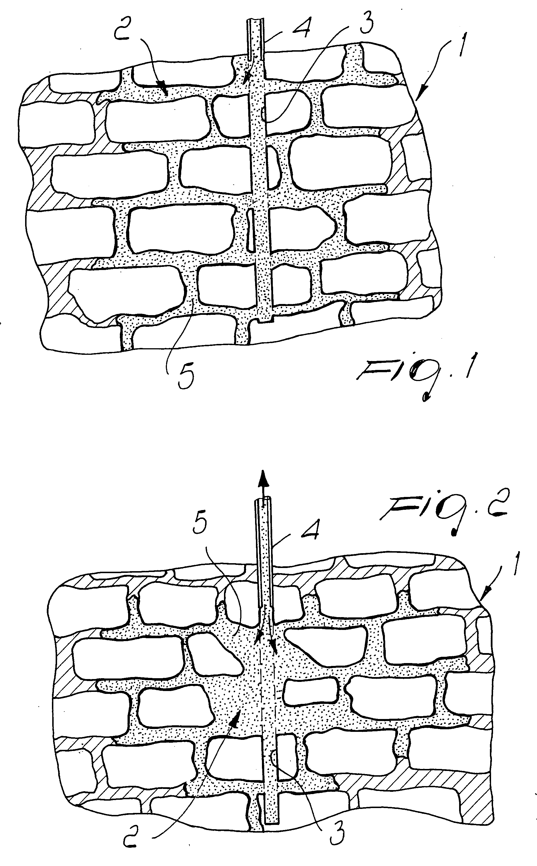 Method for repairing, waterproofing, insulating, reinforcing, restoring of wall systems