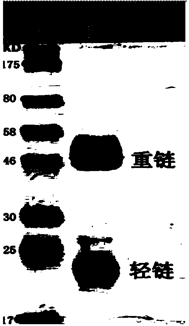 Monoclonal antibody against toxoplasma gondii as well as preparation method and application thereof