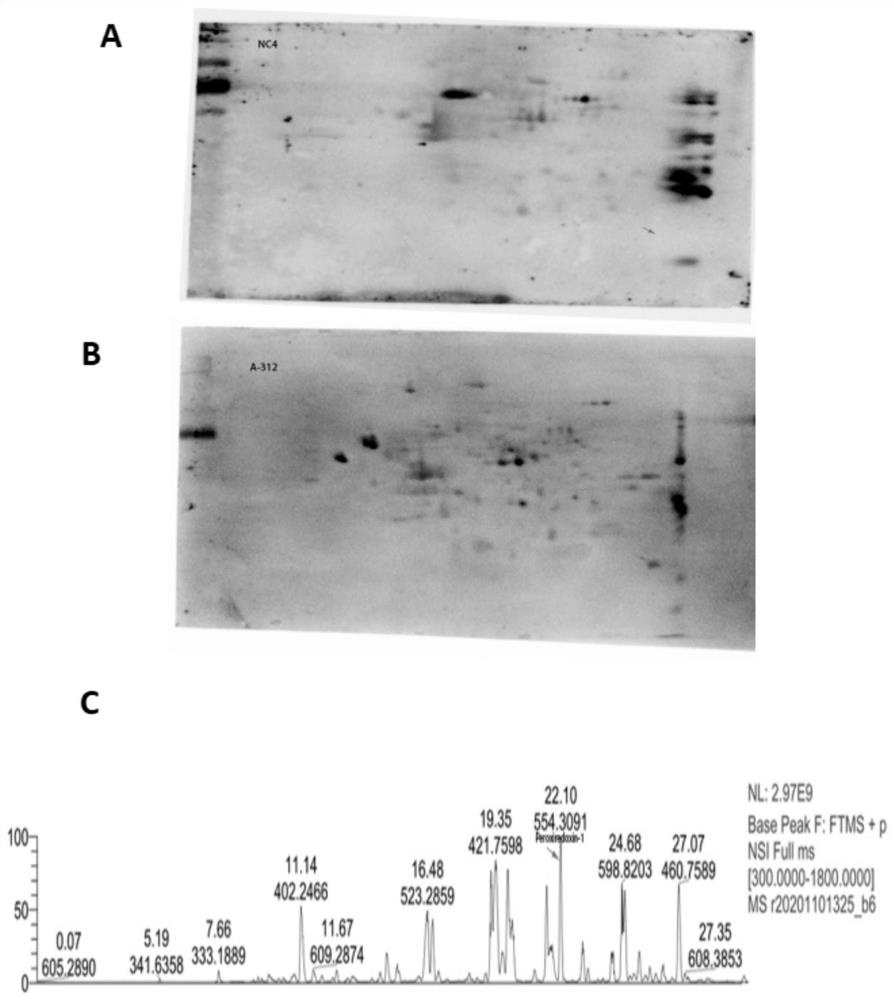 A kit for detecting anti-peroxide reductase-1-igg antibody