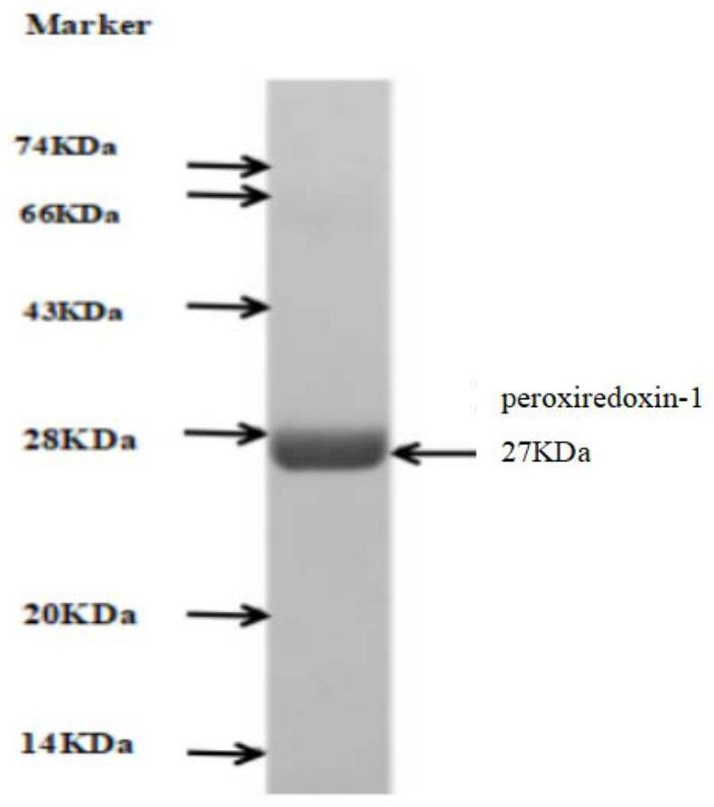 A kit for detecting anti-peroxide reductase-1-igg antibody