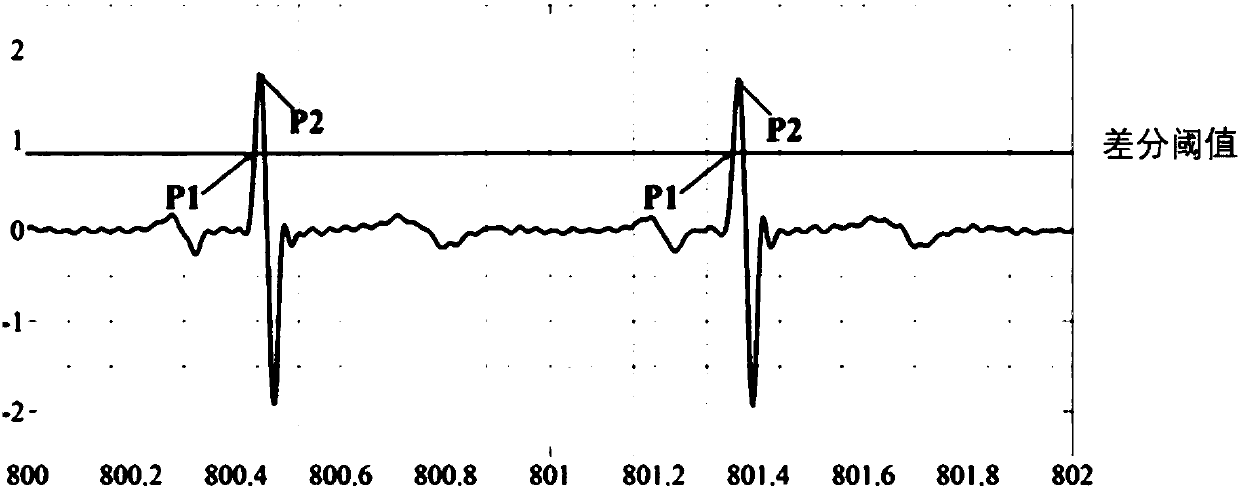 Automated detection method of QRS wave groups of electrocardiosignals