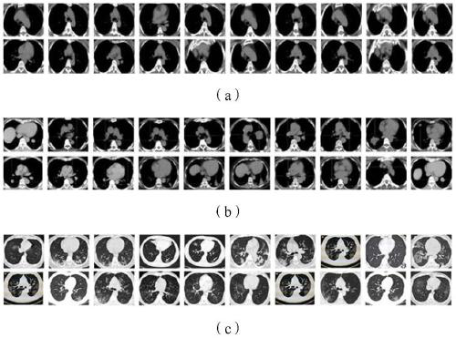 COVID-19 classification and identification method based on lung CT image