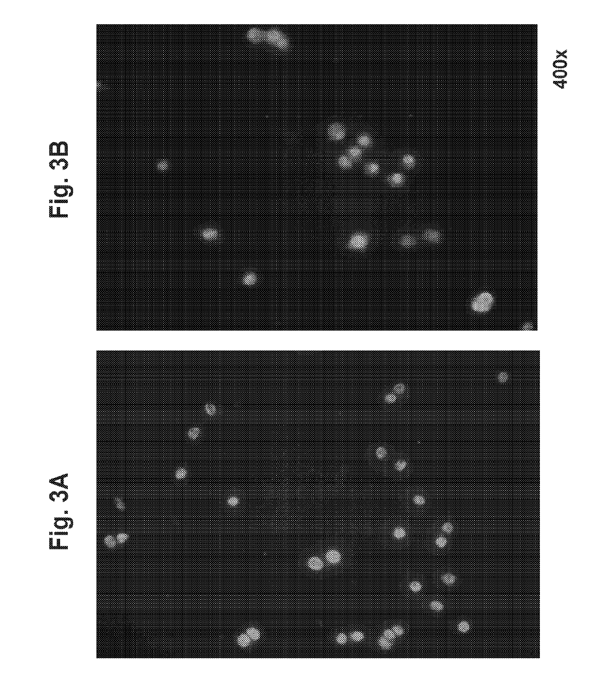 Treatment of cerebral cavernous malformations and cerebral aneurysms with rho kinase inhibitors