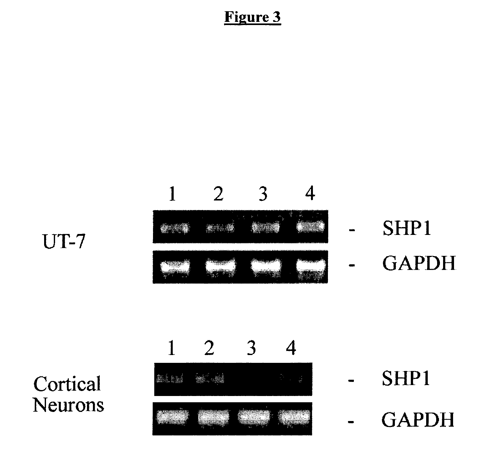 Methods for SHP1 mediated neuroprotection