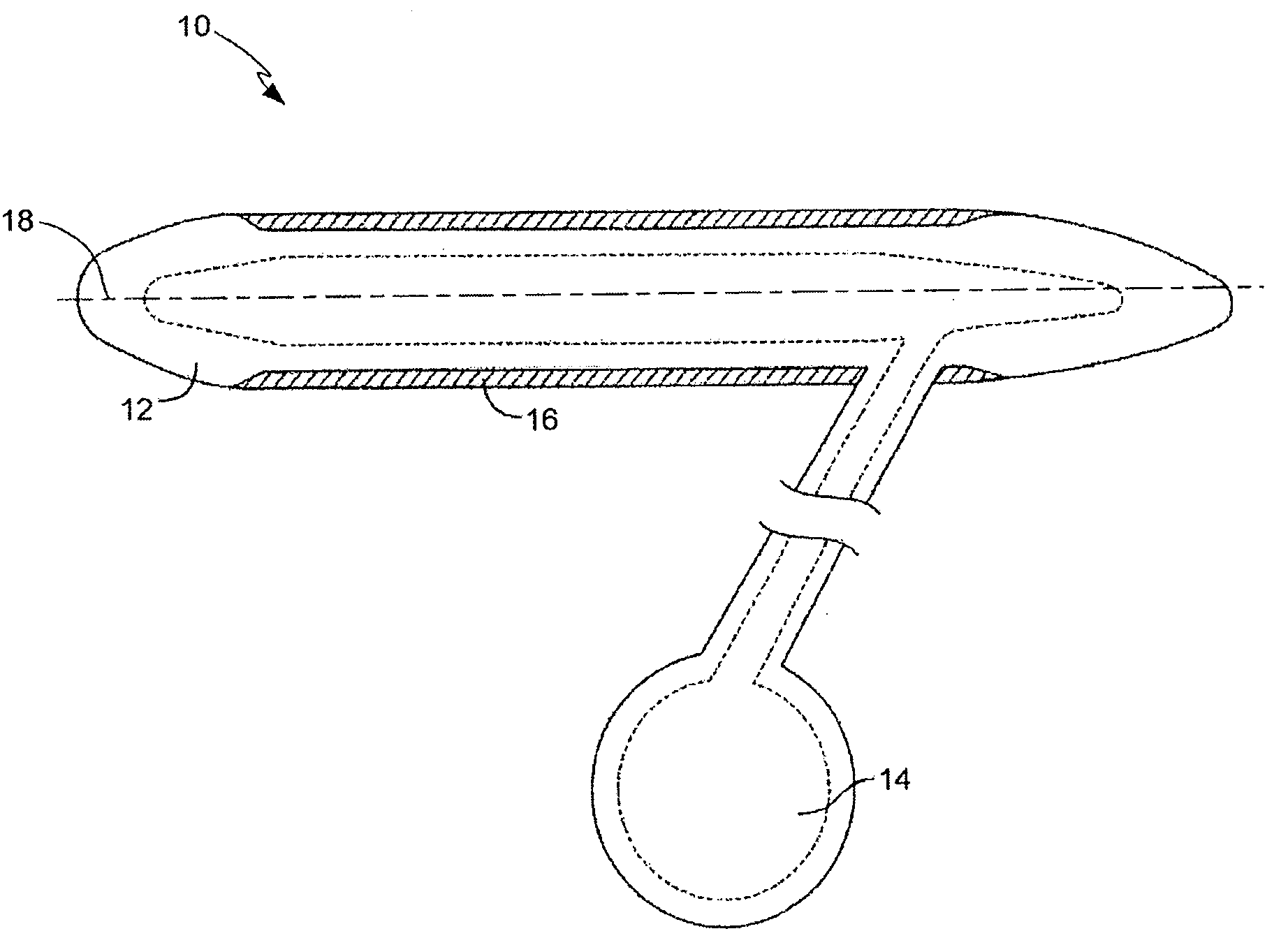 Corrugated Expansion-Constraining Sleeve for an Inflatable Penile Prosthesis Cylinder