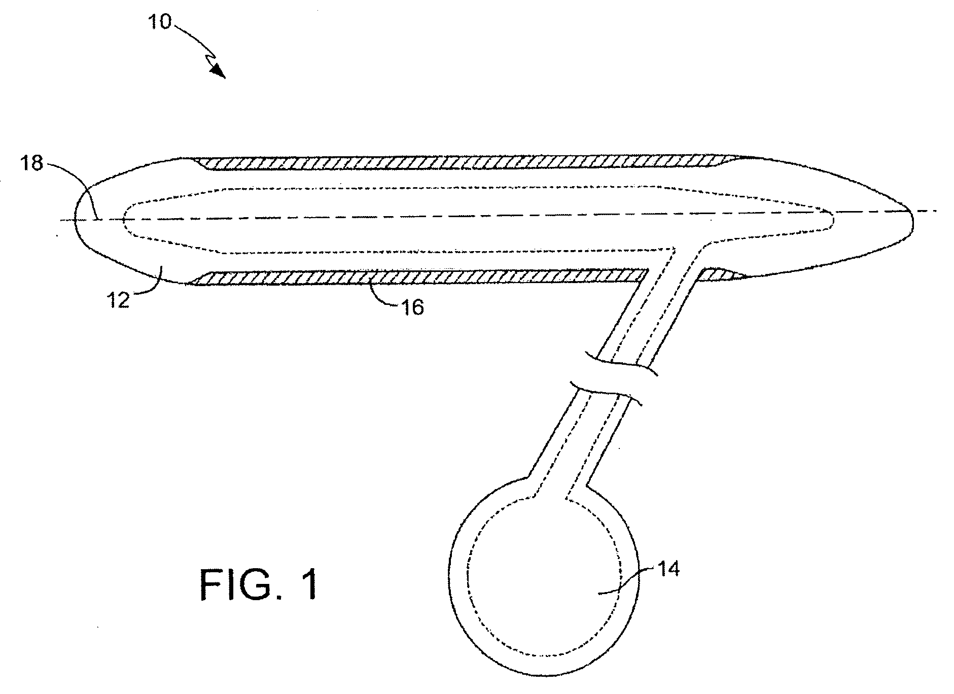 Corrugated Expansion-Constraining Sleeve for an Inflatable Penile Prosthesis Cylinder