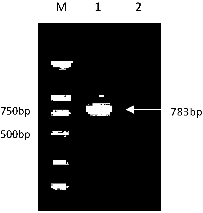 Mycoplasma bovis immune related protein, detection kit containing same and application thereof to detection of mycoplasma bovis antibody