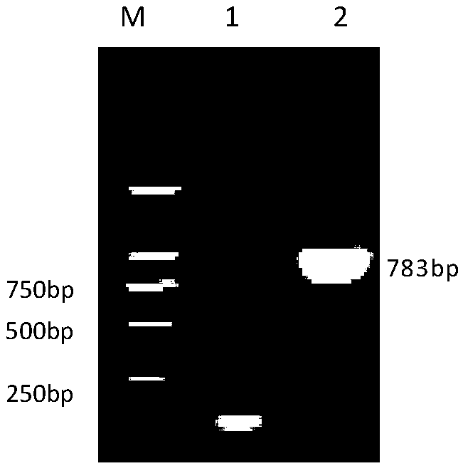 Mycoplasma bovis immune related protein, detection kit containing same and application thereof to detection of mycoplasma bovis antibody