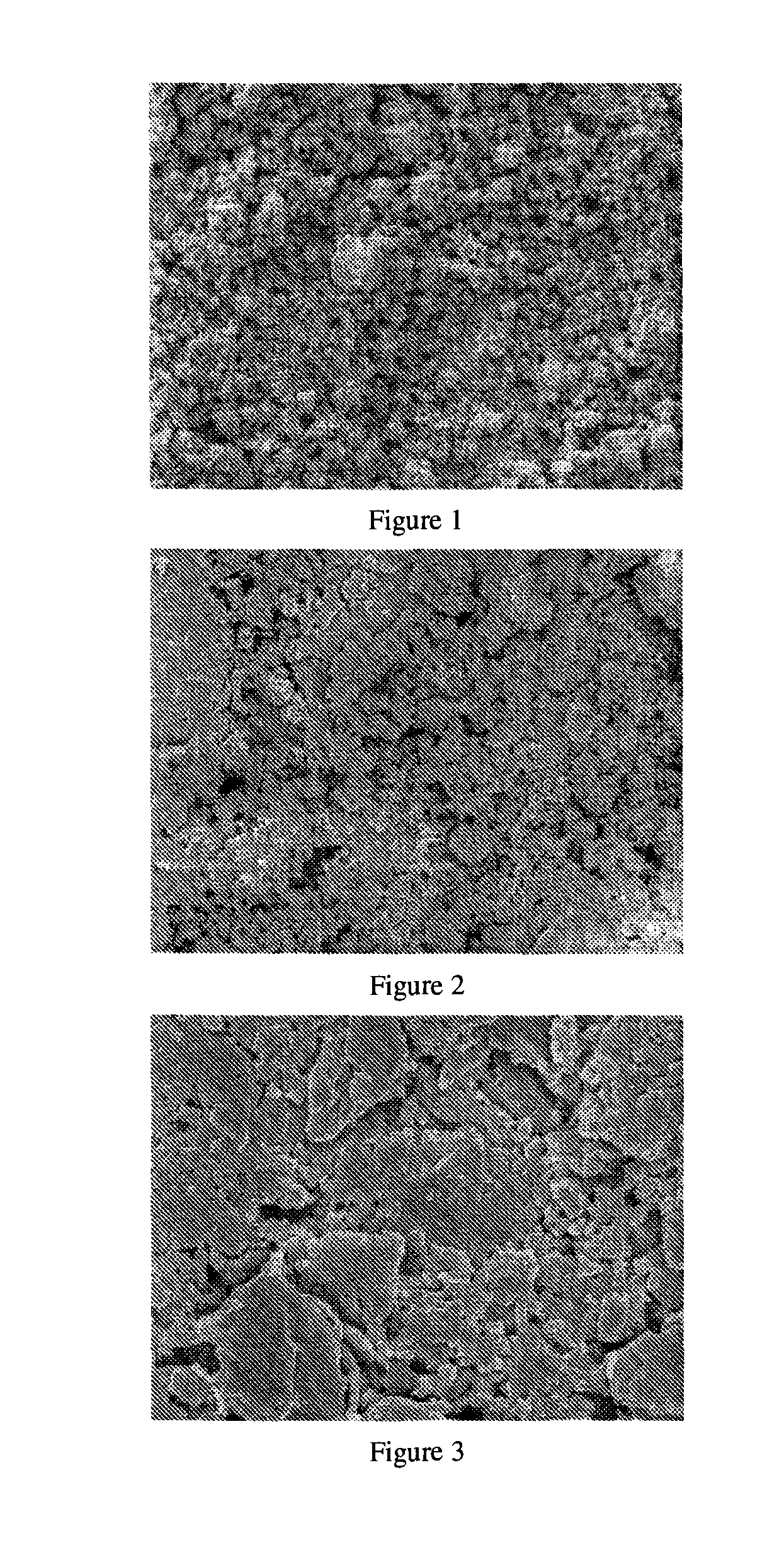 Manufacture method of metal plate substrate for computer-to-plate of inkjet printing