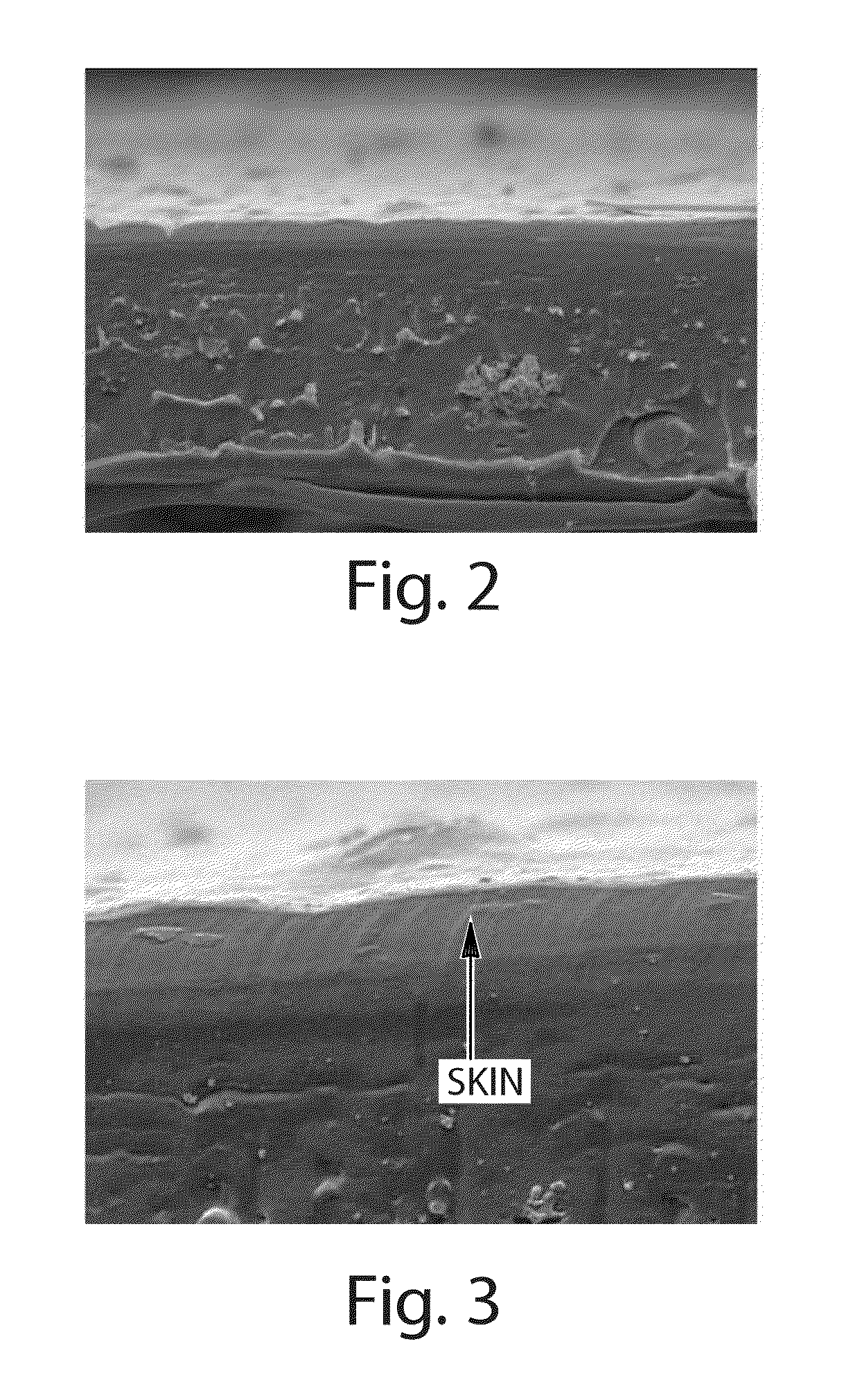 Absorbent articles comprising stretch laminates