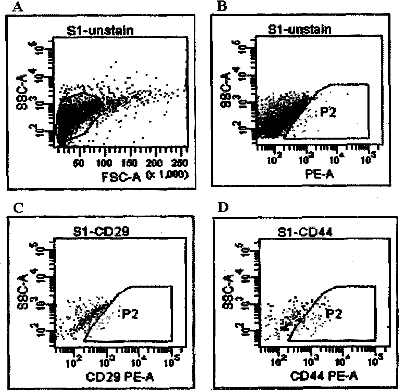 Human umbilical cordmesenchymal stem cell-derived exosome and application thereof