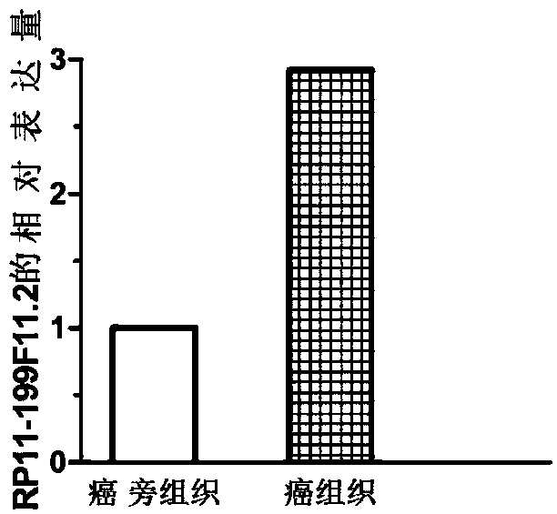 Molecular marker for development of gastric cancer diagnostic products and application