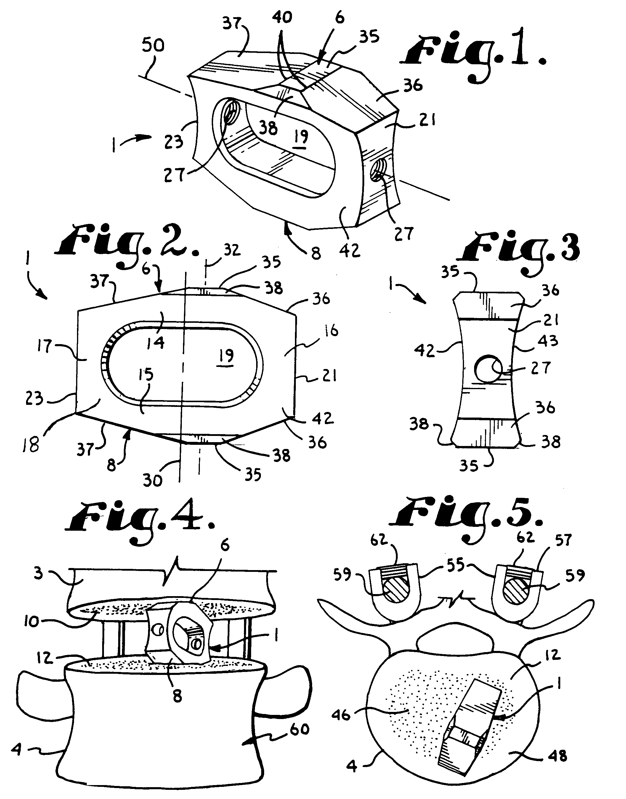 Convex spinal fusion interbody spacer