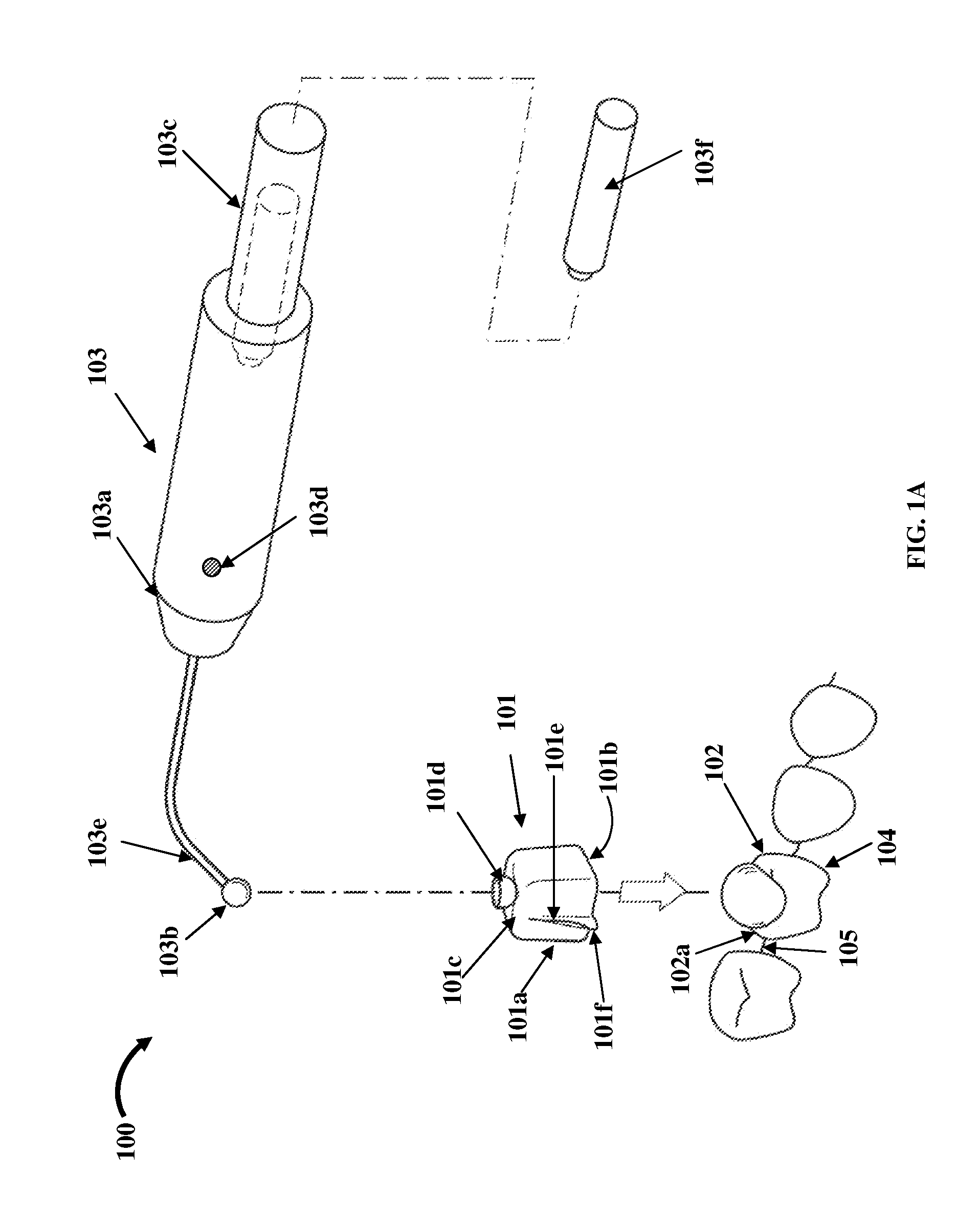 Tooth Loosening And Removal Apparatus With A Motion Transfer Member