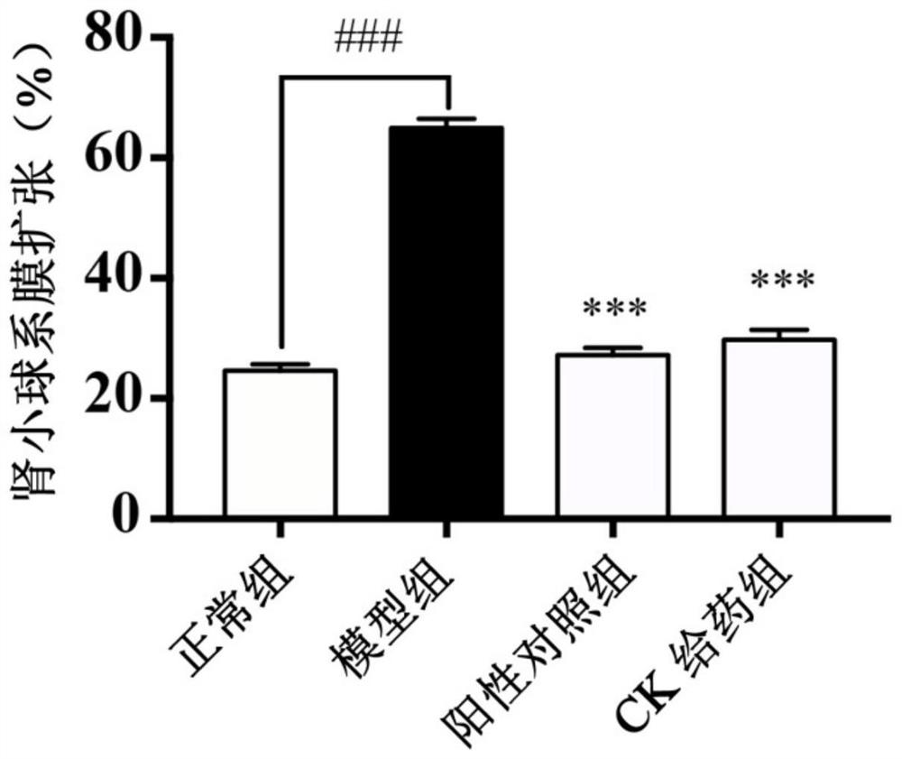 Application of ginsenoside compound K in preparation of medicine for treating diabetic kidney diseases