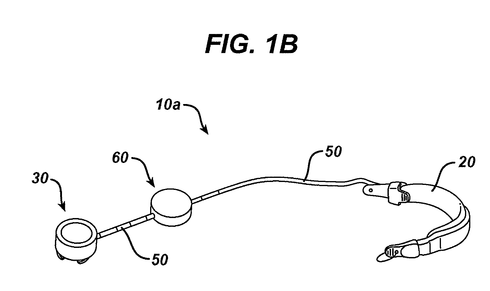 Methods and devices for measuring impedance in a gastric restriction system