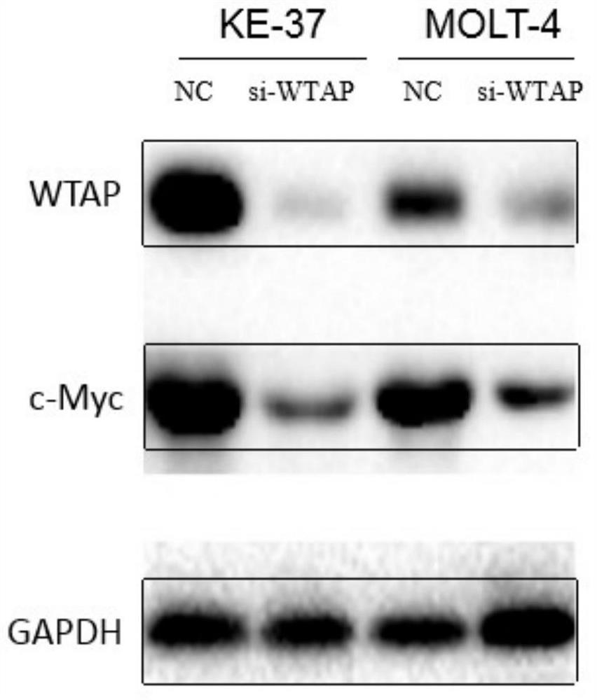 Pharmaceutical composition for treating T-cell acute lymphocytic leukemia