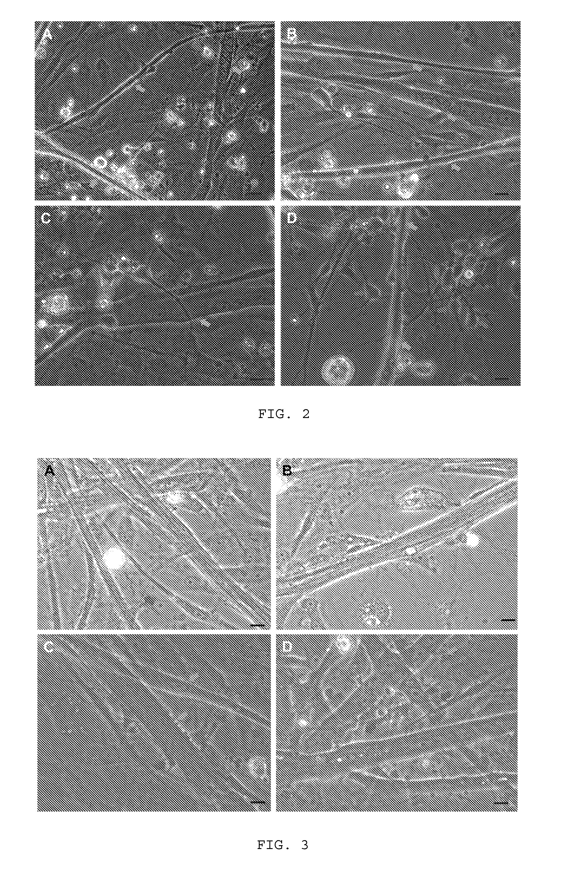 Method of co-culturing mammalian muscle cells and motoneurons
