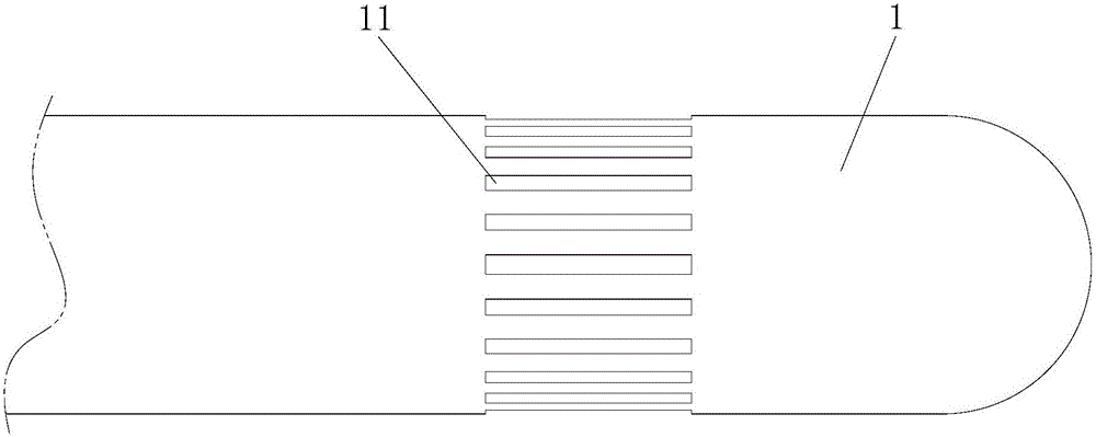 Tracheal anastomosis device