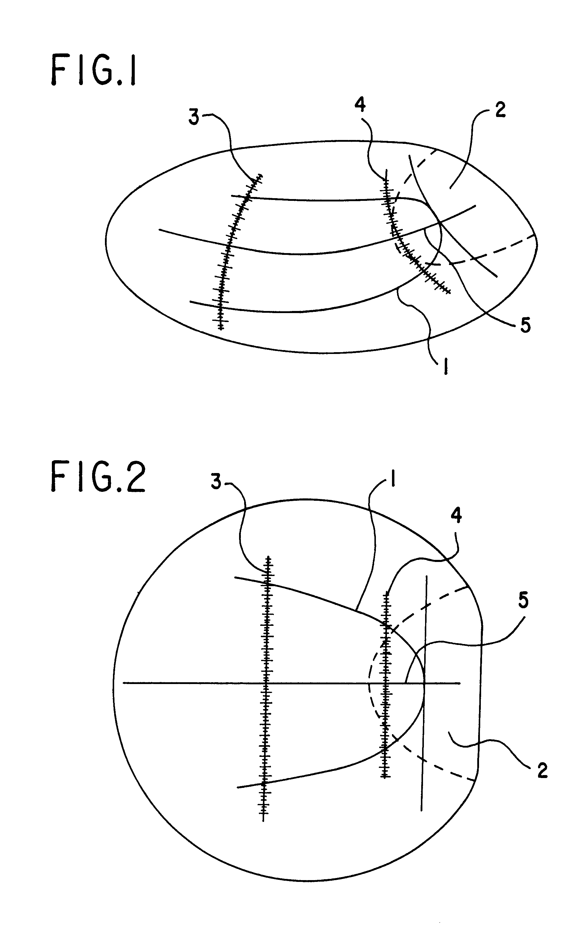 Arch wire, method for preparing the arch wire and spherical plate therefor