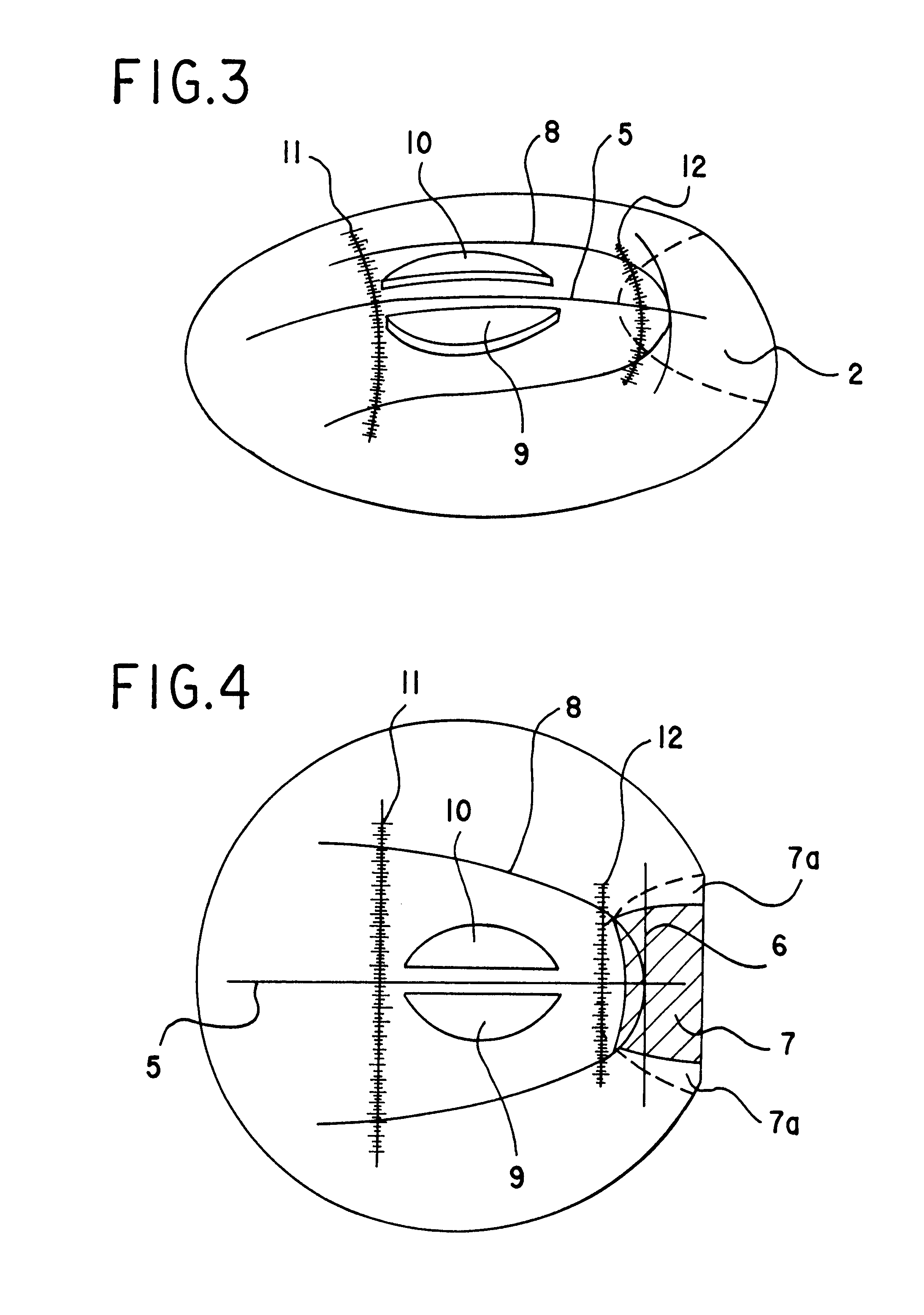Arch wire, method for preparing the arch wire and spherical plate therefor