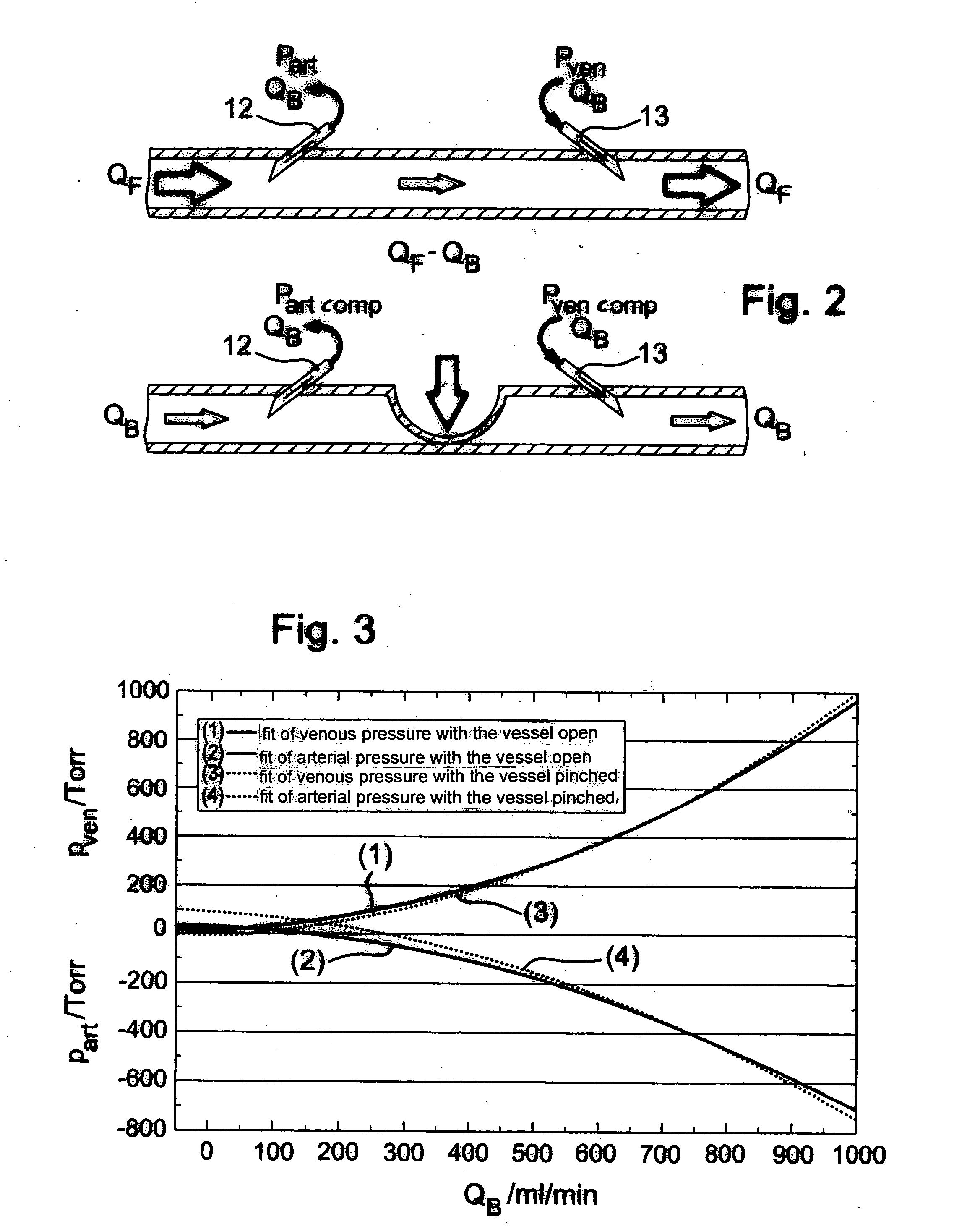 Method and device for determining blood flow in a vascular access