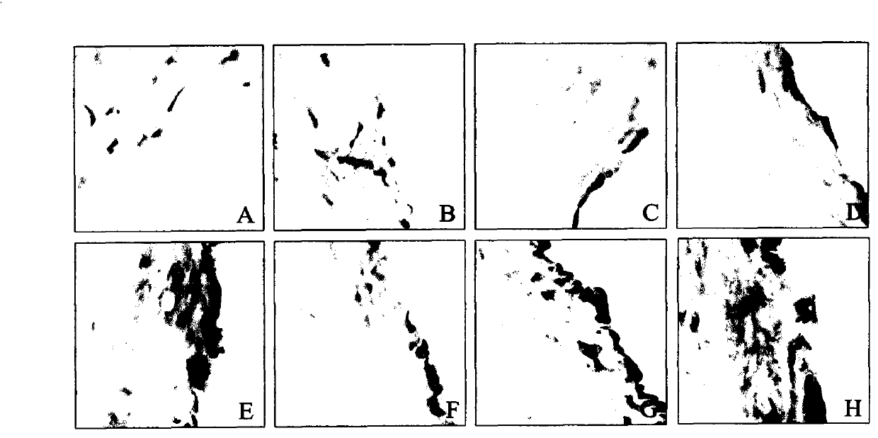 Pharmaceutical composition for preventing primary hypertension and application thereof