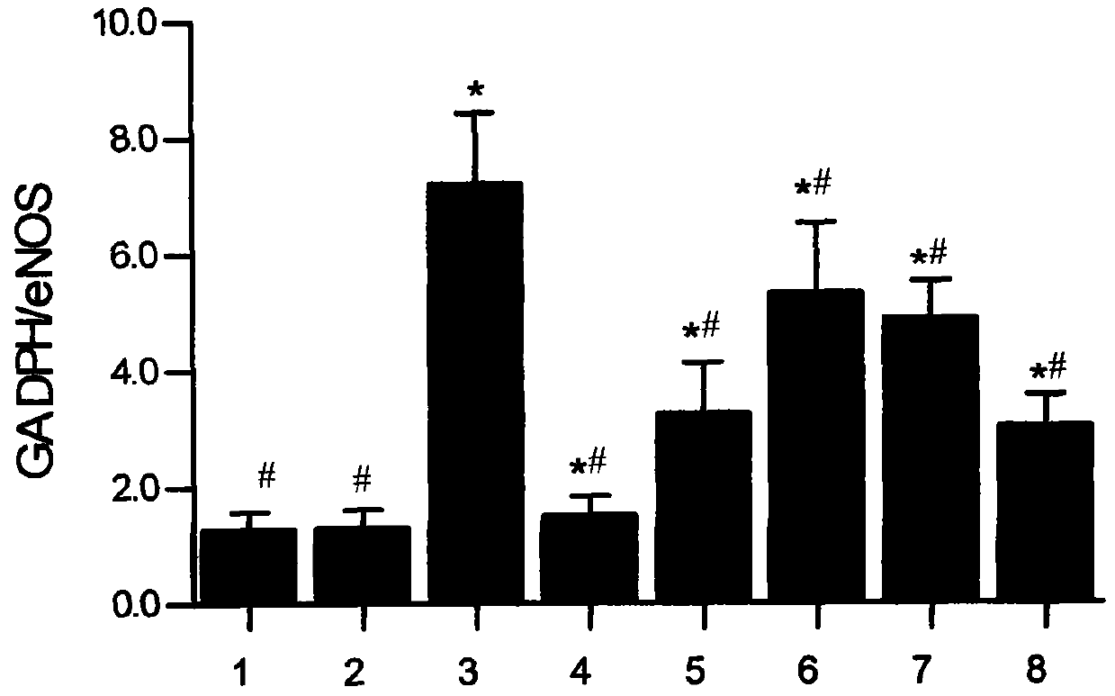 Pharmaceutical composition for preventing primary hypertension and application thereof